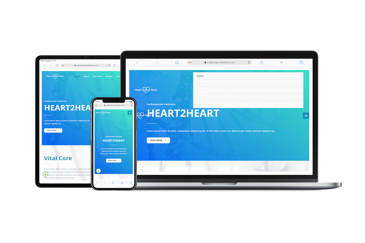 Custom website development